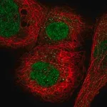 Merck Anti-MORC3 antibody produced in rabbit