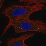 Merck Anti-ABCB9 antibody produced in rabbit