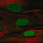 Merck Anti-SHOX antibody produced in rabbit
