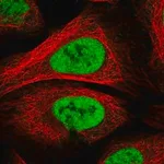 Merck Anti-PAPOLG antibody produced in rabbit