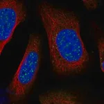 Merck Anti-BARD1 antibody produced in rabbit