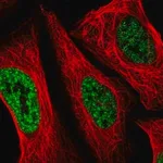 Merck Anti-SETD4 antibody produced in rabbit
