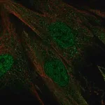 Merck Anti-CERKL antibody produced in rabbit