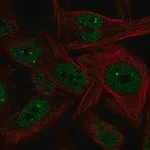 Merck Anti-NME5 antibody produced in rabbit