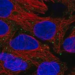 Merck Anti-ANKRD6 antibody produced in rabbit