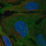 Merck Anti-ARHGAP19 antibody produced in rabbit