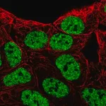 Merck Anti-EPHB6 antibody produced in rabbit