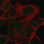 Merck Anti-HOXD11 antibody produced in rabbit