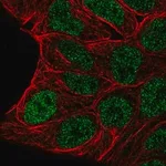 Merck Anti-EVX1 antibody produced in rabbit