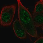 Merck Anti-FANCM antibody produced in rabbit