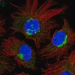 Merck Anti-FKBP9 antibody produced in rabbit