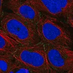 Merck Anti-ARVCF antibody produced in rabbit