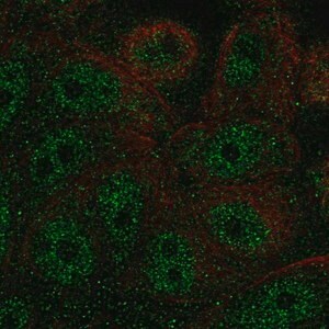 Merck Anti-FBP2 antibody produced in rabbit