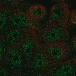 Merck Anti-FBP2 antibody produced in rabbit