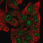 Merck Anti-ZNF517 antibody produced in rabbit