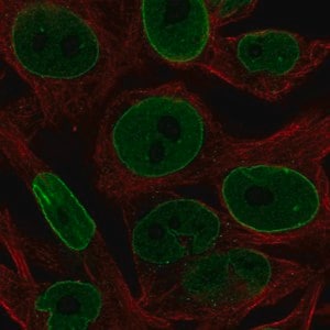 Merck Anti-BCL2 antibody produced in rabbit