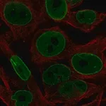 Merck Anti-BCL2 antibody produced in rabbit