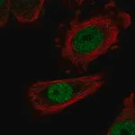 Merck Anti-ZHX1 antibody produced in rabbit