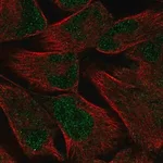 Merck Anti-PKNOX2 antibody produced in rabbit