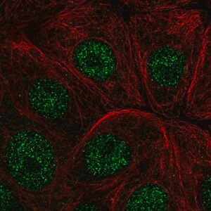 Merck Anti-IER2 antibody produced in rabbit