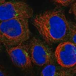 Merck Anti-PIDD1 antibody produced in rabbit