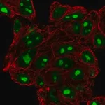 Merck Anti-DPH6 antibody produced in rabbit