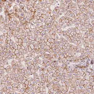 Merck Anti-SLC17A4 antibody produced in rabbit