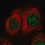 Merck Anti-TBRG1 antibody produced in rabbit
