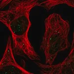 Merck Anti-PLAGL1 antibody produced in rabbit