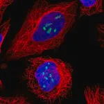 Merck Anti-TBL3 antibody produced in rabbit