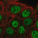 Merck Anti-CPSF1 antibody produced in rabbit