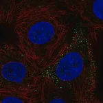 Merck Anti-FERMT3 antibody produced in rabbit