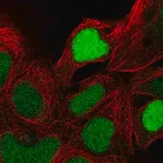 Merck Anti-ZNF444 antibody produced in rabbit