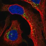 Merck Anti-PPP2R3A antibody produced in rabbit