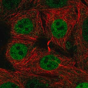 Merck Anti-SIVA1 antibody produced in rabbit