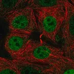 Merck Anti-SIVA1 antibody produced in rabbit