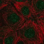 Merck Anti-RNASEH2C antibody produced in rabbit