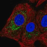 Merck Anti-GGT1 antibody produced in rabbit