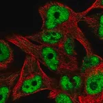 Merck Anti-ZNF559 antibody produced in rabbit