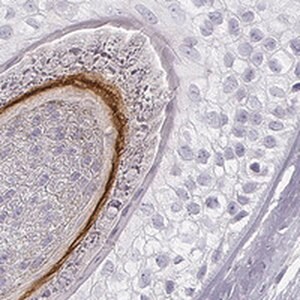 Merck Anti-KRT72 antibody produced in rabbit