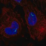 Merck Anti-RORC antibody produced in rabbit