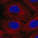 Merck Anti-FBXL3 antibody produced in rabbit