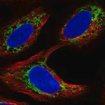 Merck Anti-AR antibody produced in rabbit