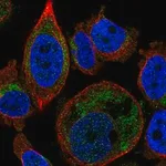 Merck Anti-SLC25A16 antibody produced in rabbit