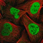 Merck Anti-TOPBP1 antibody produced in rabbit