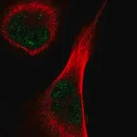 Merck Anti-TEX15 antibody produced in rabbit