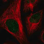 Merck Anti-CFAP58 antibody produced in rabbit