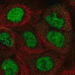 Merck Anti-TOPBP1 antibody produced in rabbit