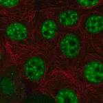 Merck Anti-HELQ antibody produced in rabbit