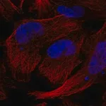 Merck Anti-GEMIN5 antibody produced in rabbit